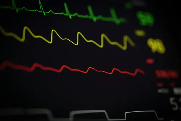Die EKG-Falle